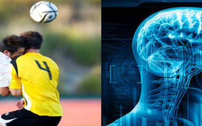 Concussion and Soccer/Football