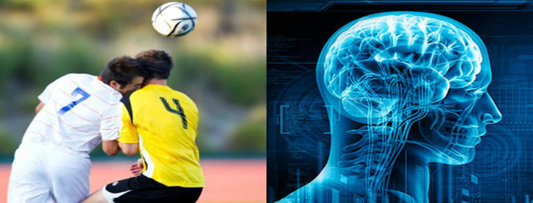 Concussion and Soccer/Football